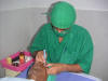 Performing eye surgery